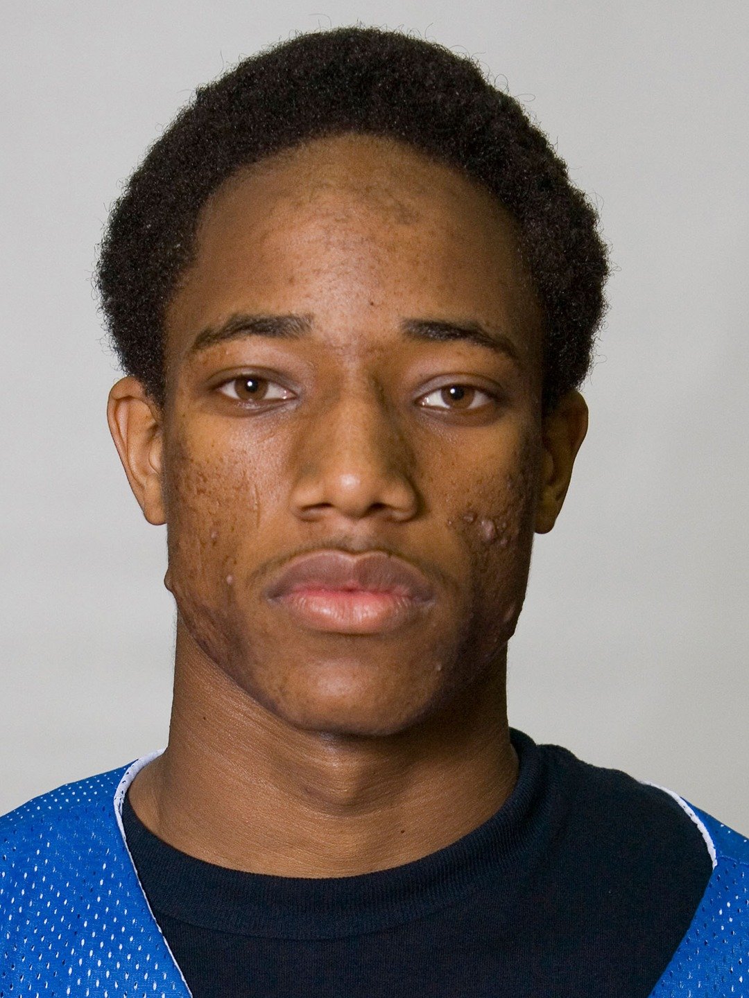 demar derozan pe